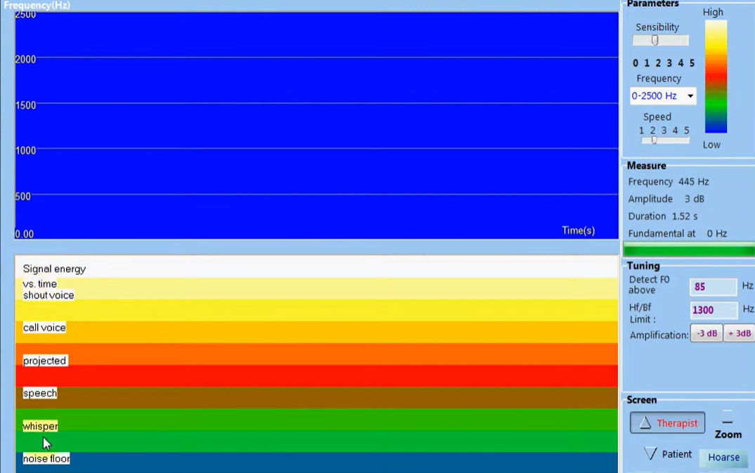 Displaying power and Spectrogram